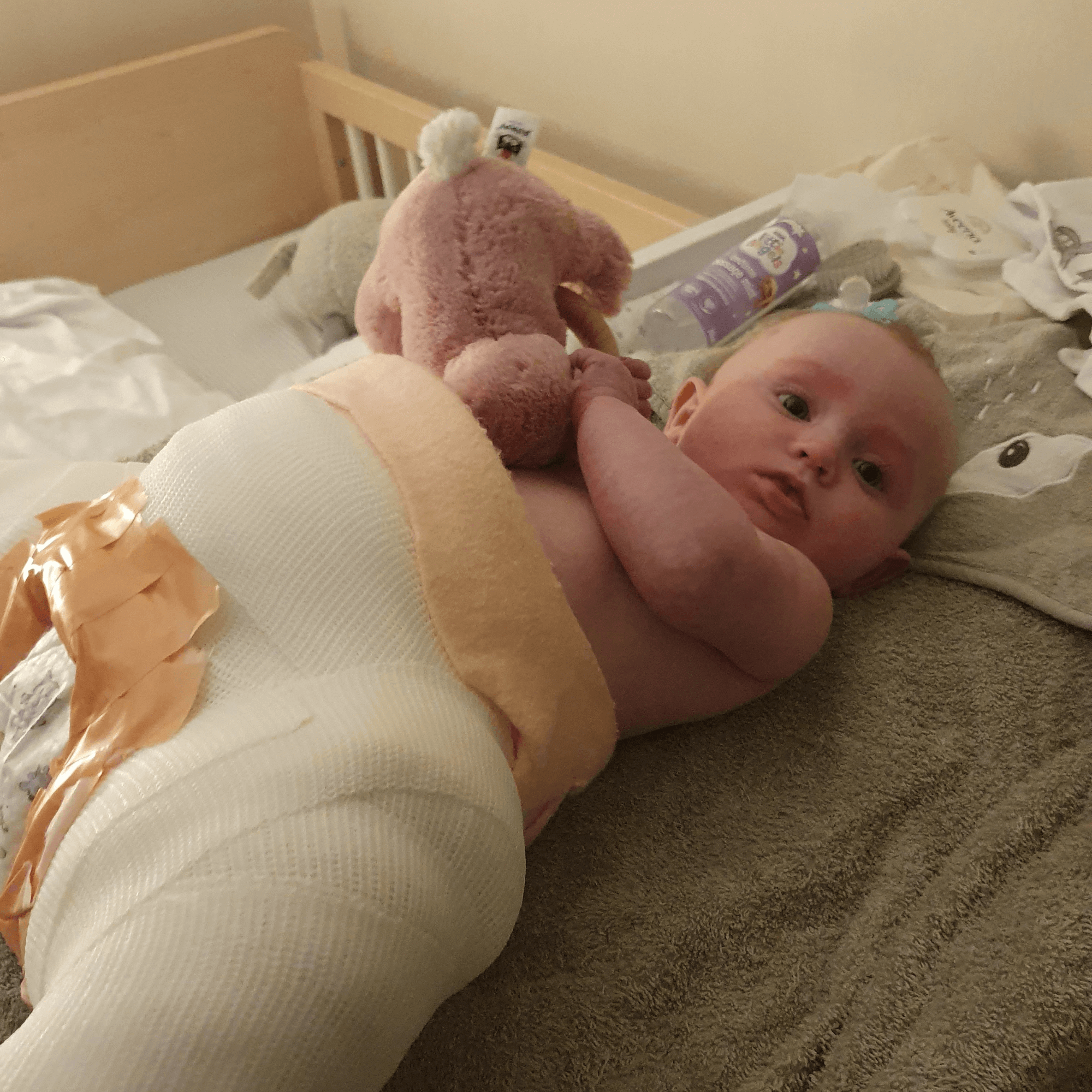 Beautiful 4 month old baby lying on the bed in a hip spica cast playing with toy | Hip Dysplasia - Clair de Lune UK